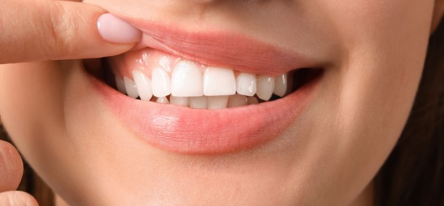 periodoncia en tunja